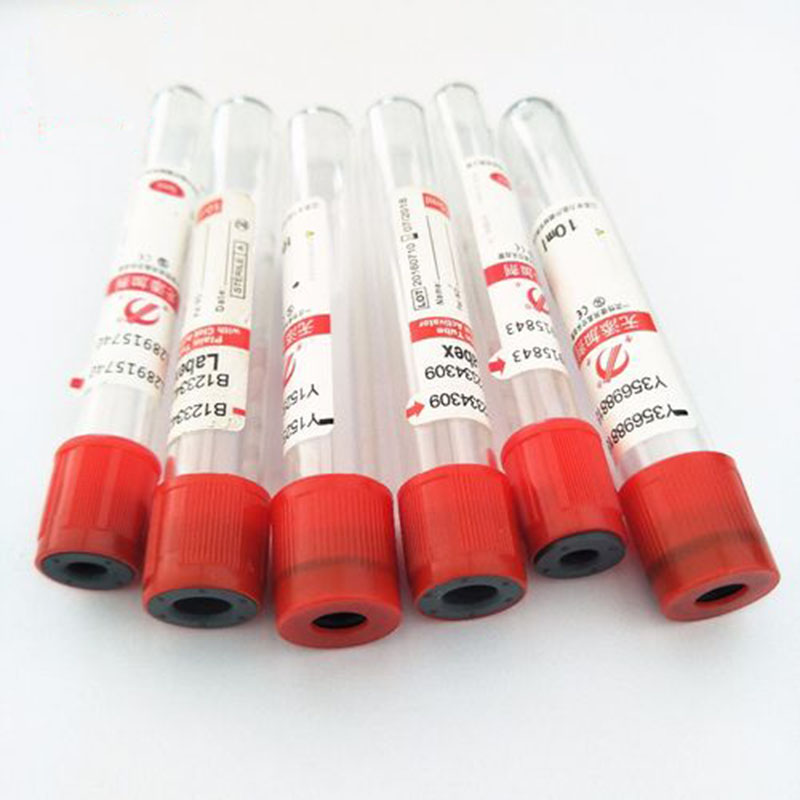 100 pz/lotto 3ml 5ml 10ml Vetr - Blood Collection Tube recensione e prezzo